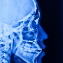 X-ray of side of human head