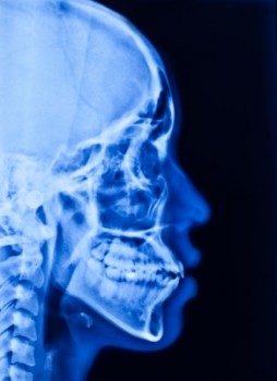 X-ray of side of human head
