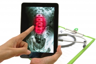 Tablet in use by doctor for spine xray